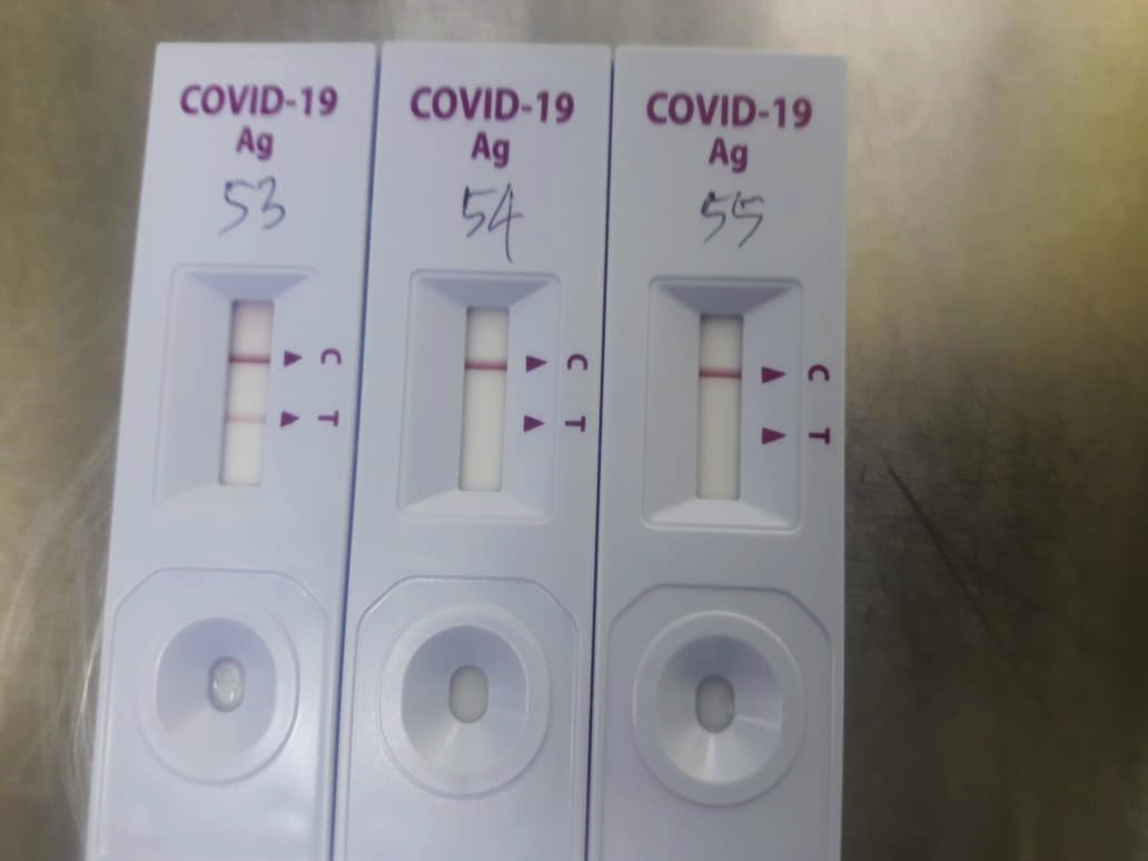 PCR vs Pengujian Antigen: Tes Covid-19 mana yang tepat untuk saya?